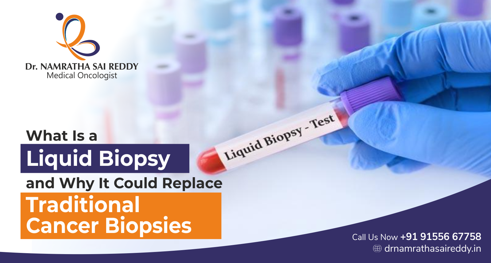 Liquid biopsy allows doctors to analyse cancer-related DNA from a simple blood sample without removing tumour tissue.