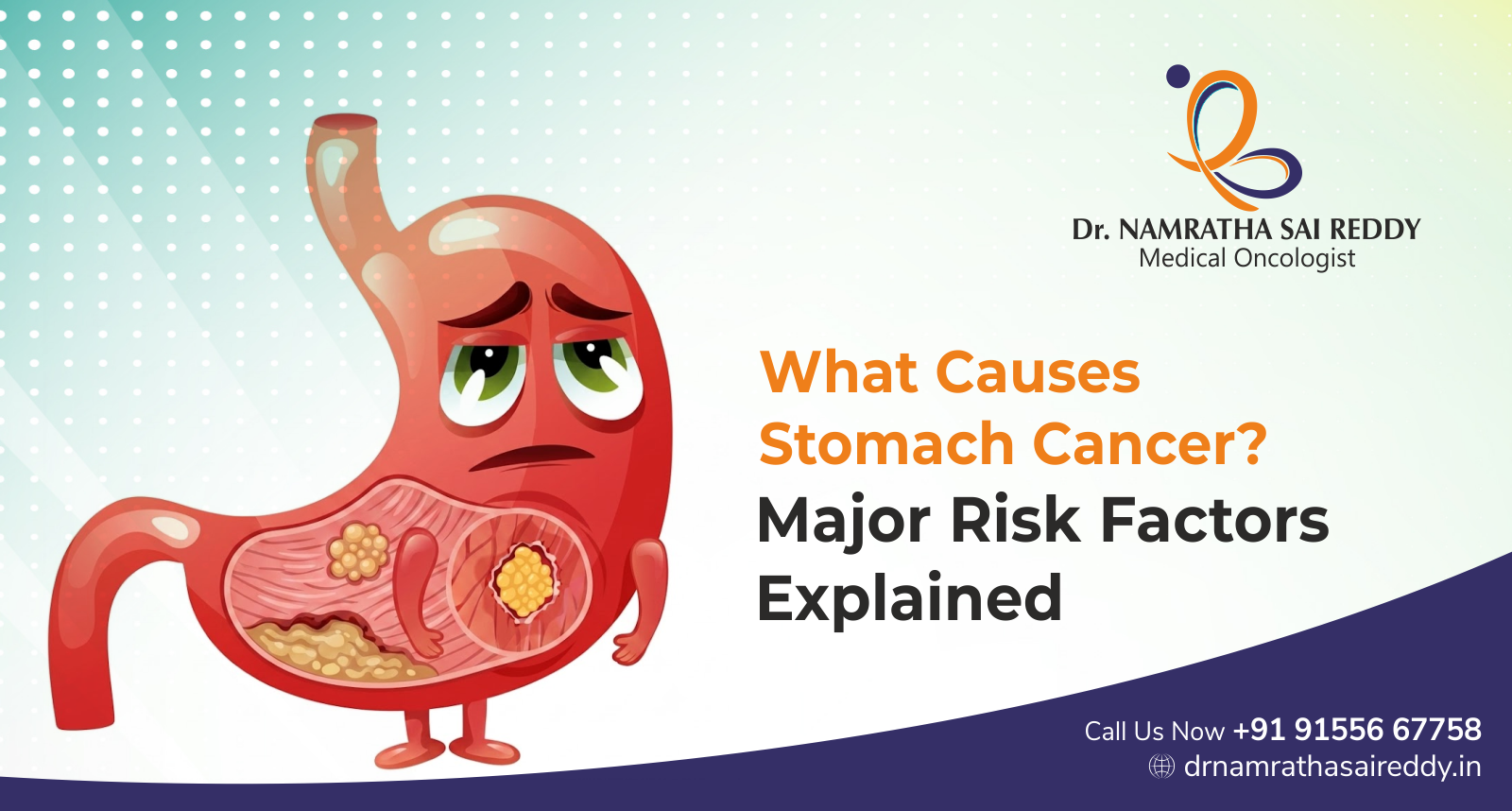 Long-term H. pylori infection, smoking, obesity, and diets high in processed foods are among the leading risk factors for stomach cancer.