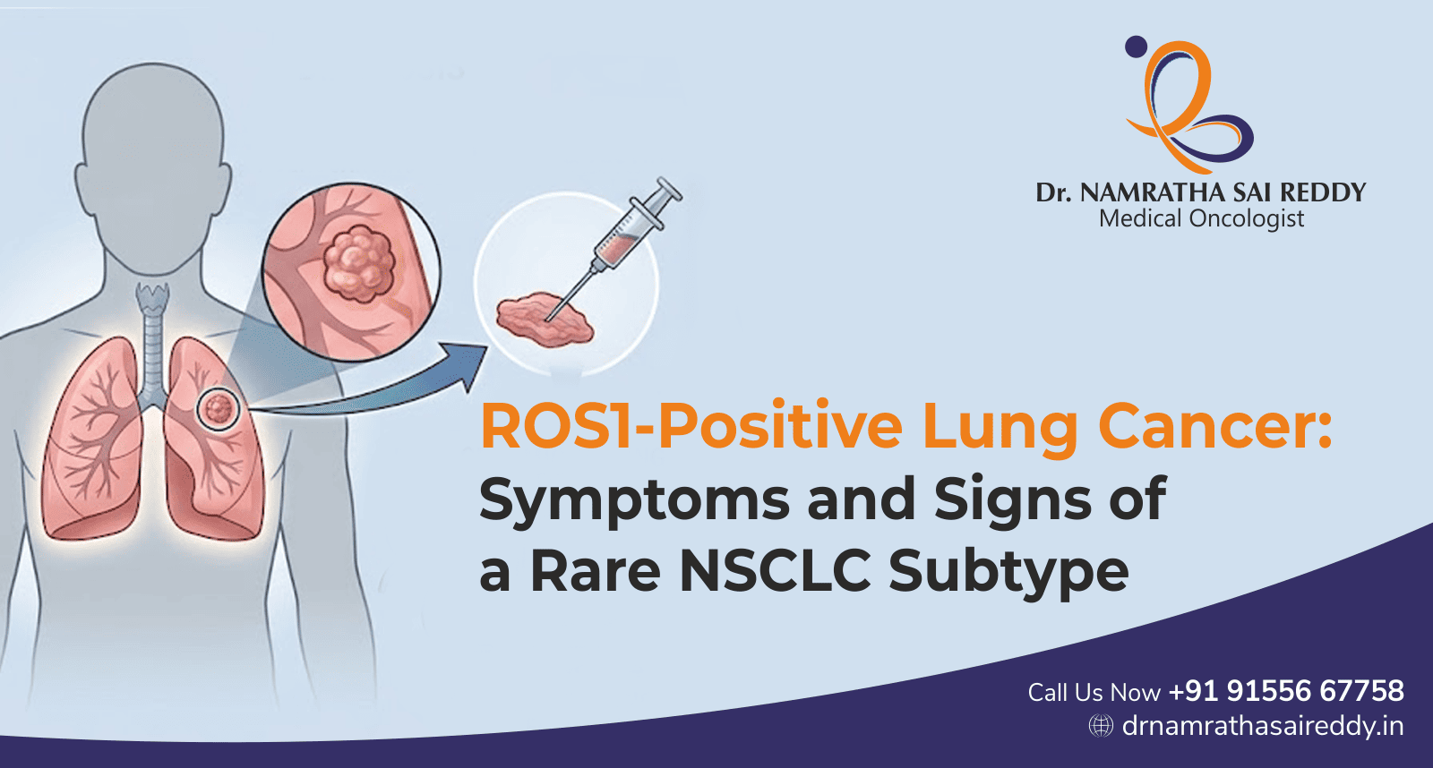 ROS1-Positive Lung Cancer Symptoms and Signs of a Rare NSCLC Subtype